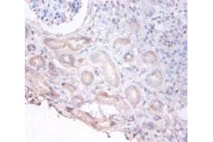 Immunohistochemistry of paraffin-embedded human kidney tissue using ABIN7149438 at dilution of 1:100