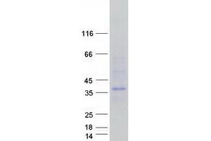 Validation with Western Blot