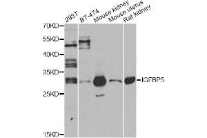 Western blot analysis of extracts of various cell lines, using IGFBP5 antibody (ABIN6292146) at 1:1000 dilution. (IGFBP5 anticorps)