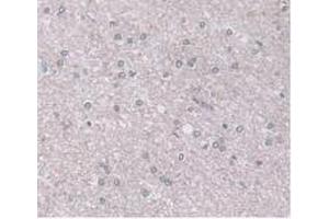 IHC-P analysis of Human Brain Tissue, with DAB staining. (ORM1 anticorps  (AA 19-201))