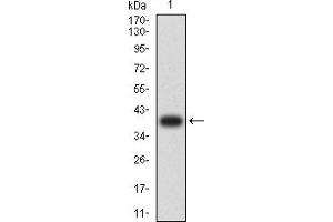 Western blot analysis using COL3A1 mAb against human COL3A1 (AA: 24-153) recombinant protein. (COL3A1 anticorps  (AA 24-153))