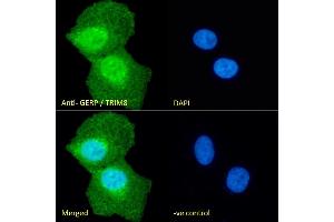 (ABIN184949) Immunofluorescence analysis of paraformaldehyde fixed U2OS cells, permeabilized with 0.
