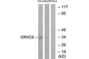 Western blot analysis of extracts from HeLa/HepG2 cells, using OR4C6 Antibody. (OR4C6 anticorps  (AA 193-242))