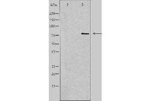 Western blot analysis of extracts from COLO cells, using CNKR1 antibody. (CNKSR1 anticorps  (Internal Region))