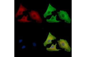 ABIN7097093 and ABIN7101160 staining  cells by IF/ICC.