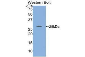Western Blotting (WB) image for anti-Adenylate Cyclase 5 (ADCY5) (AA 167-385) antibody (ABIN3206692) (ADCY5 anticorps  (AA 167-385))
