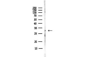Western blot analysis of lysates from MCF7 cells(heat-shock,45 min treatment), using ITM2C Antibody at 1/1000 dilution.