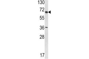 Western blot analysis of VDU1 antibody and T47D lysate.