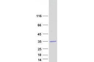 Validation with Western Blot