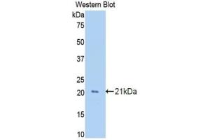Western blot analysis of the recombinant protein. (GAS6 anticorps  (AA 356-511))