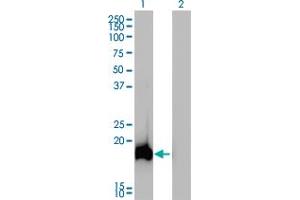 Western Blot analysis of AHNAK expression in transfected 293T cell line by AHNAK monoclonal antibody (M01), clone 3G7. (AHNAK anticorps  (AA 1-100))