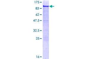 Image no. 1 for Hematopoietic Cell-Specific Lyn Substrate 1 (HCLS1) (AA 1-486) protein (GST tag) (ABIN1306429)
