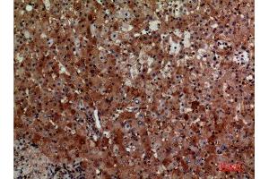 Immunohistochemistry (IHC) analysis of paraffin-embedded Human Liver, antibody was diluted at 1:100.