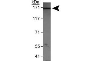 Western blot analysis of WHSC1L1 (isoform 1) in HeLa nuclear extracts with WHSC1L1 polyclonal antibody . (WHSC1L1 anticorps  (AA 300-400))