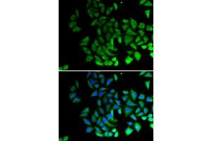 Immunofluorescence (IF) image for anti-Piwi-Like 1 (PIWIL1) antibody (ABIN6219364) (PIWIL1 anticorps)