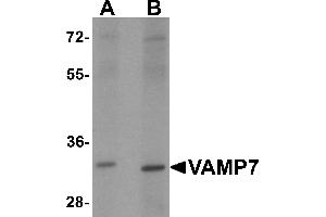 Western blot analysis of VAMP7 in mouse lung tissue lysate with VAMP7 antibody at 1 µg/mL. (VAMP7 anticorps)