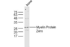 Bone lysates probed with Myelin Protein Zero Polyclonal Antibody, Unconjugated  at 1:300 dilution and 4˚C overnight incubation.