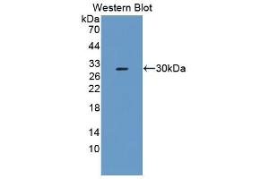 Figure. (Fibrosin anticorps  (AA 1-250))