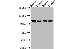 Western Blot Positive WB detected in: Rat heart tissue, Rat kidney tissue, Mouse heart tisseu, Mouse kidney tissue All lanes: ITGA6 antibody at 3 μg/mL Secondary Goat polyclonal to rabbit IgG at 1/50000 dilution Predicted band size: 127, 120, 123, 122, 125, 107 kDa Observed band size: 100 kDa (ITGA6 anticorps  (AA 625-866))