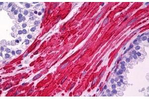 Anti-LDLRAP1 antibody IHC staining of human prostate, smooth muscle. (LDLRAP1 anticorps  (AA 1-264))