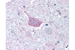 Anti-MRGPRD antibody IHC of human brain, medulla. (MRGPRD anticorps  (Cytoplasmic Domain))