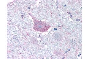 Anti-MRGPRD antibody IHC of human brain, medulla. (MRGPRD anticorps  (Cytoplasmic Domain))