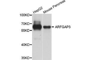 Western blot analysis of extract of HepG2 and mouse pancreas cells, using ARFGAP3 antibody. (ARFGAP3 anticorps)