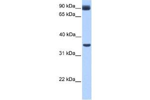 Western Blotting (WB) image for anti-Potassium Inwardly-Rectifying Channel, Subfamily J, Member 5 (KCNJ5) antibody (ABIN2458042) (KCNJ5 anticorps)