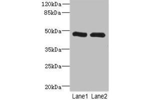 Western blot All lanes: HGDantibody at 2. (HGD anticorps  (AA 226-445))