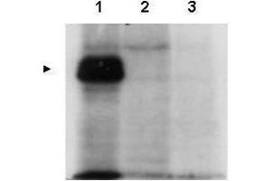 Western blot using  affinity purified anti-MLF1IP antibody shows detection of MLF1IP (arrowhead) in HeLa cells transfected with ZZ-tagged MLF1IP (Lane 1). (MLF1 anticorps  (Thr78))