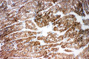 Anti-NDUFA1 antibody, IHC(F) IHC(F): Rat Cardiac Muscle Tissue (NDUFA1 anticorps  (C-Term))