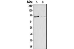 Western blot analysis of Arylsulfatase E expression in HepG2 (A), HEK293T (B) whole cell lysates. (Arylsulfatase E anticorps  (Center))