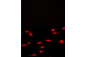 Immunofluorescence (IF) image for anti-SET Domain Containing (Lysine Methyltransferase) 8 (SETD8) antibody (ABIN2995295)