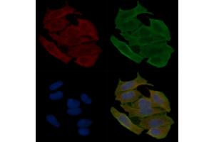 ABIN6262729 and ABIN6278925 staining Hela cells(30 min of UV treatment) by IF/ICC. (Keratin 6 anticorps  (C-Term))