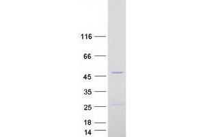 Validation with Western Blot (LACC1 Protein (Transcript Variant 1) (Myc-DYKDDDDK Tag))