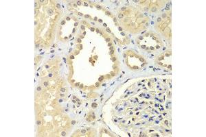 Immunohistochemistry of paraffin-embedded human kidney using ZNF346 antibody (ABIN5971759) at dilution of 1/100 (40x lens). (ZNF346 anticorps)
