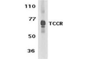 Western blot analysis of TCCR expression in human spleen tissue lysate with this product at 1 μg /ml. (IL27 Receptor alpha anticorps  (C-Term))