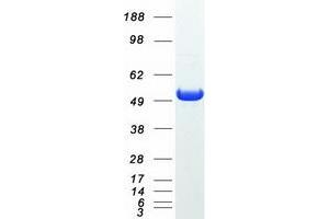Validation with Western Blot