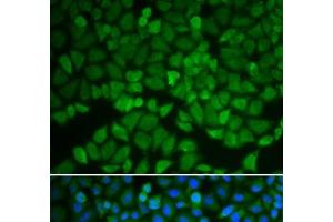 Immunofluorescence analysis of A549 cells using GSS Polyclonal Antibody (Glutathione Synthetase anticorps)