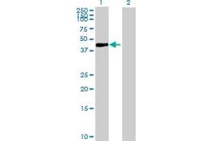 Western Blot analysis of ADA expression in transfected 293T cell line by ADA MaxPab polyclonal antibody. (ADA anticorps  (AA 1-363))