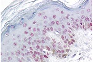 Human Skin: Formalin-Fixed, Paraffin-Embedded (FFPE)