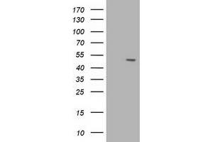 Western Blotting (WB) image for anti-Adaptor-Related Protein Complex 2, mu 1 Subunit (AP2M1) antibody (ABIN1496652) (AP2M1 anticorps)