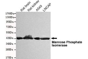Western blot detection of Mannose Phosphate Isomerase in Rat kidney,Rat brain,A549 and Lncap cell lysates and using Mannose Phosphate Isomerase mouse mAb (1:1000 diluted). (MPI anticorps)