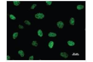 Immunostaining analysis in HeLa cells. (CBP anticorps)