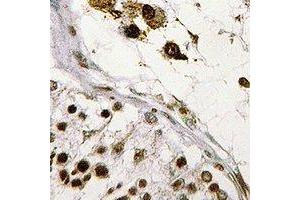 Immunohistochemical analysis of ASF1B staining in human testis formalin fixed paraffin embedded tissue section. (ASF1B anticorps)