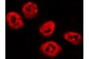 ABIN6275834 staining HepG2 by IF/ICC.