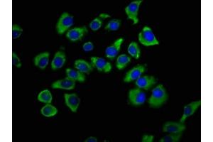 Immunofluorescence staining of A549 cells with ABIN7170348 at 1:200, counter-stained with DAPI. (SNX12 anticorps  (AA 2-172))