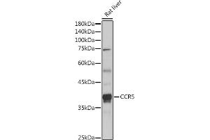 Western blot analysis of extracts of Rat liver, using CCR5 antibody (ABIN7266307) at 1:1000 dilution. (CCR5 anticorps  (AA 100-200))