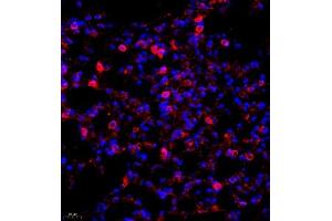 Immunofluorescence (IF) image for anti-Chloride Intracellular Channel 6 (CLIC6) antibody (ABIN7073478)