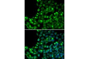 Immunofluorescence analysis of U20S cell using MGMT antibody.